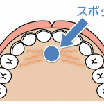 歯並びに影響する癖？