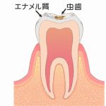 C1と治療法