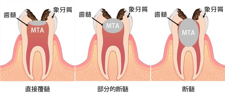 治療料金
